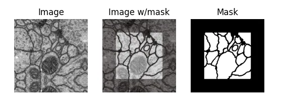 A sample from the electron microscopy dataset