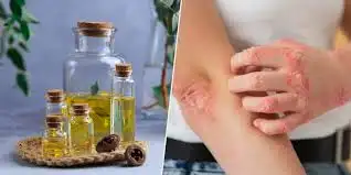 Homemade Oil Tincture